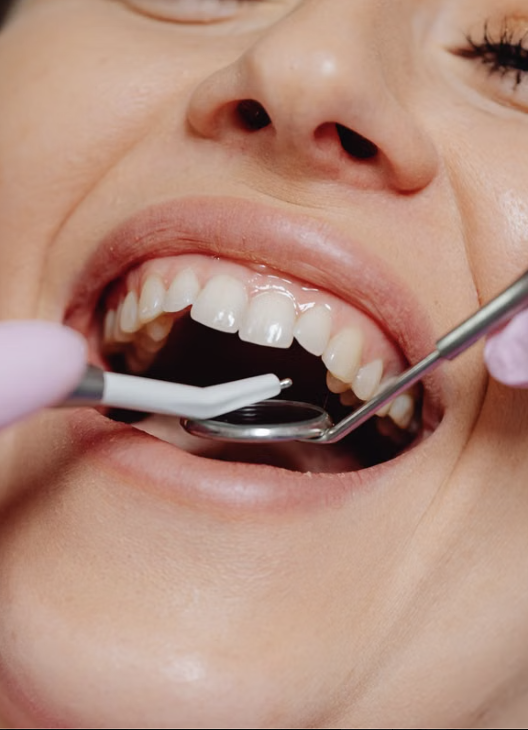 Periodoncia